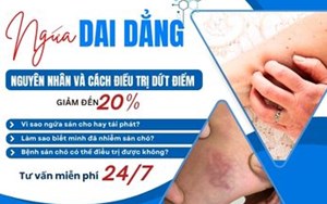 NGỨA DAI DẲNG? NGUYÊN NHÂN VÀ CÁCH ĐIỀU TRỊ DỨT ĐIỂM